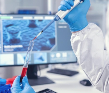 5 Dicas para uma pipetagem mais precisa
