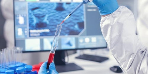 5 Dicas para uma pipetagem mais precisa