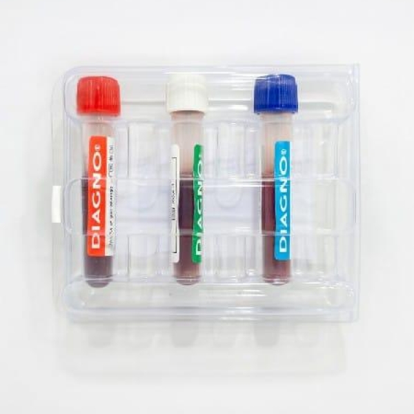 SANGUE CONTROLE D CHECK 5 DIFF (23003) - DIAGNO